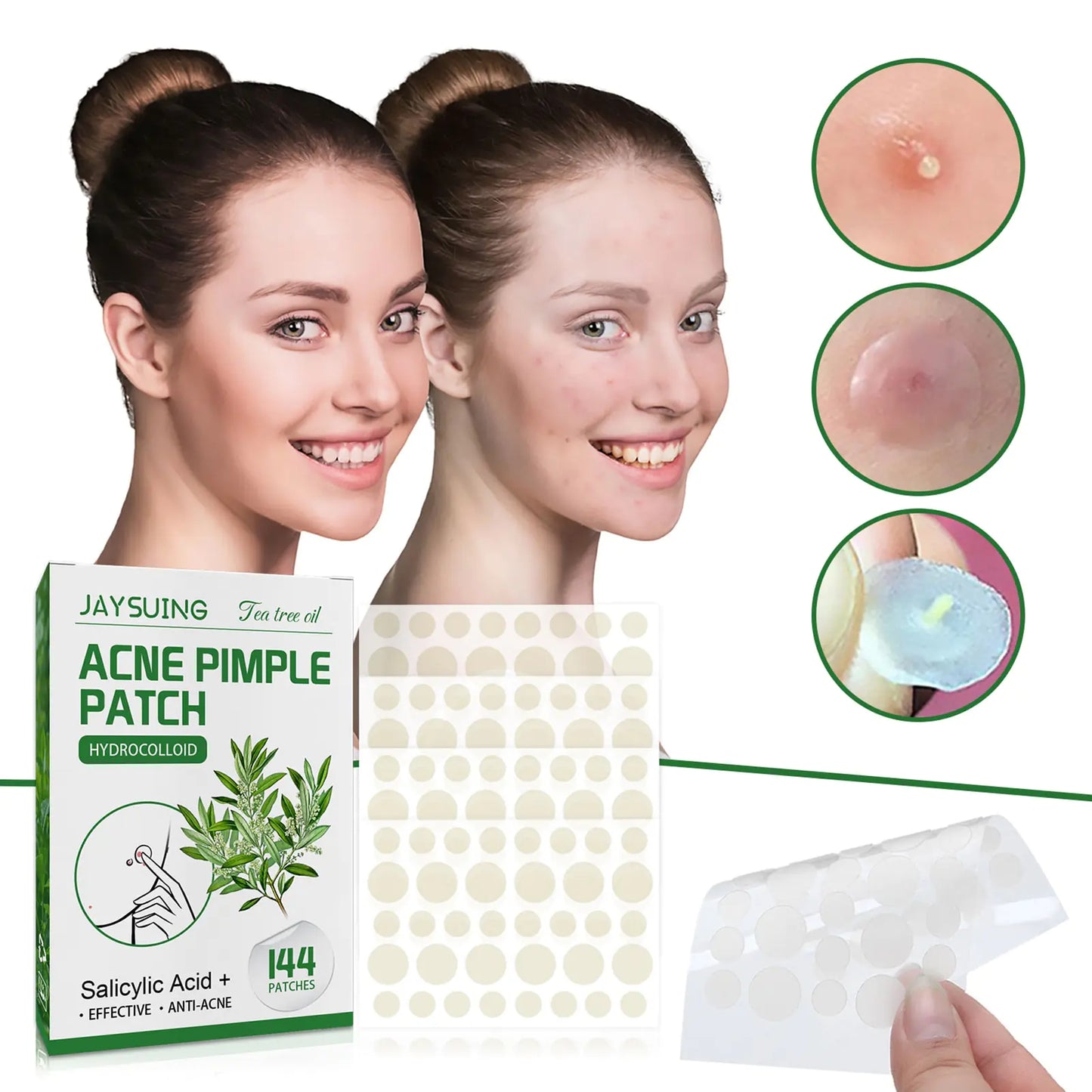 Soft Shield Pimple Patch - velvetglow Beauty mixology