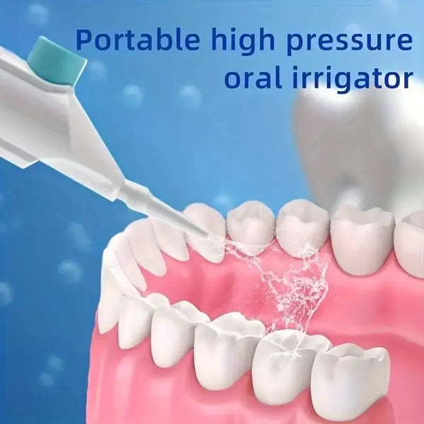 Household High Pressure Oral Irrigator Portable Teeth Clean Water - velvetglow