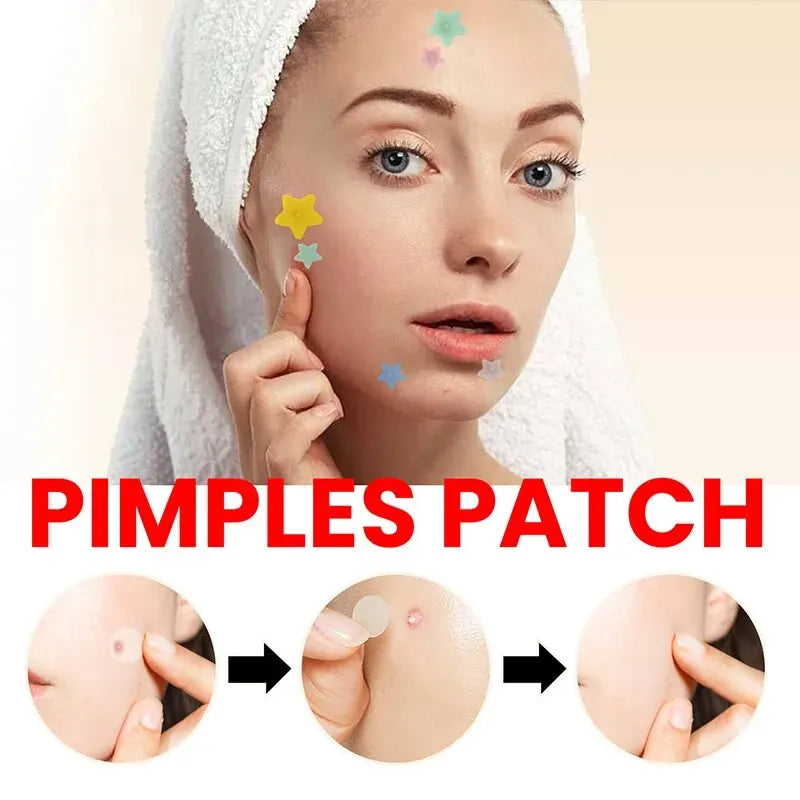 Repair Acne Patch Facial Skin Care Fade Blemishes Pimple Marks Closed - velvetglow Beauty mixology