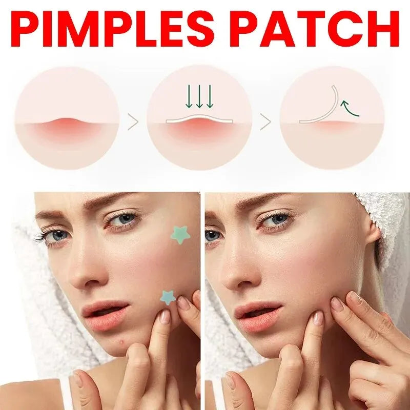 Repair Acne Patch Facial Skin Care Fade Blemishes Pimple Marks Closed - velvetglow Beauty mixology