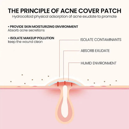 Repair Acne Patch Facial Skin Care Fade Blemishes Pimple Marks Closed - velvetglow