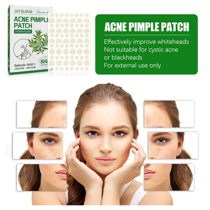 Soft Shield Pimple Patch - velvetglow